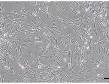 脂肪幹細胞 細胞写真